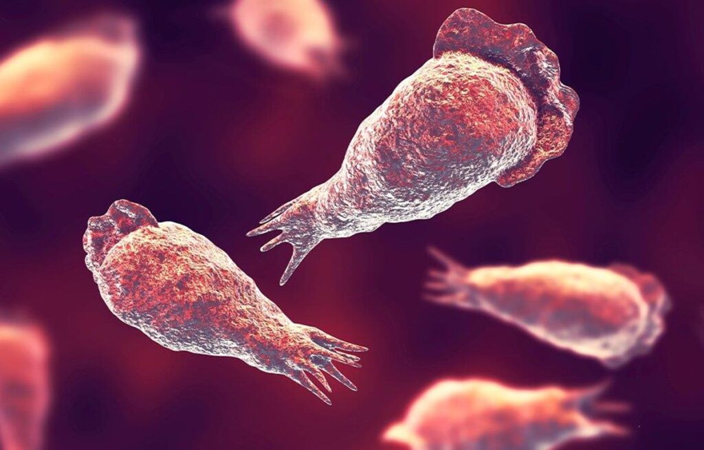 Viêm màng não do amip 