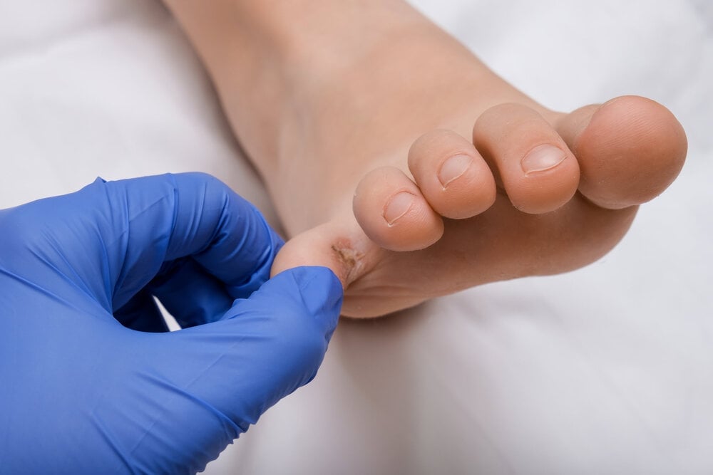 Thăm khám bác sĩ để chẩn đoán bệnh tốt nhất