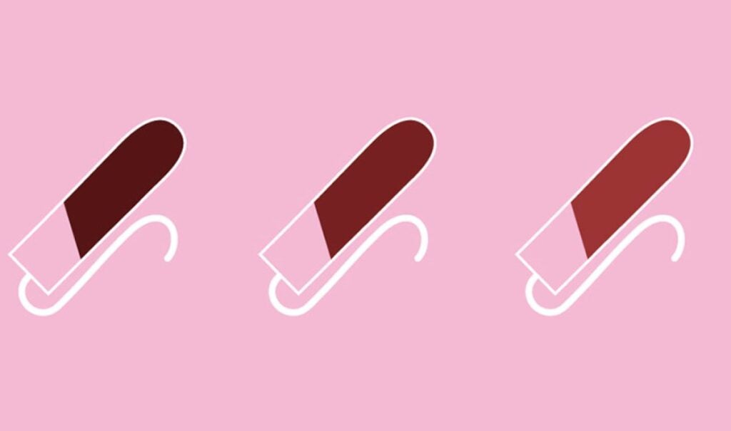 Kinh nguyệt màu nâu có thể cảnh báo về một số bệnh phụ khoa 