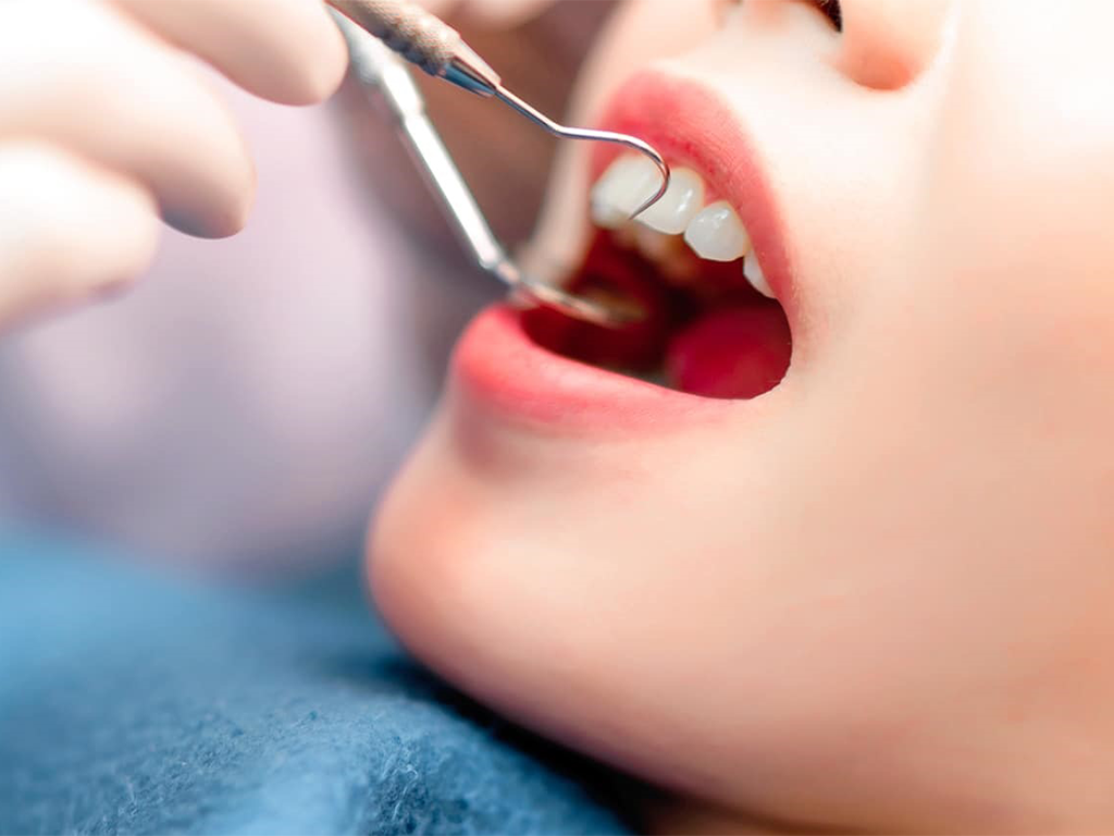 Bước 4 - Dùng dụng cụ chuyên dụng để thực hiện quá trình điều trị tủy 