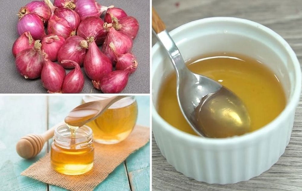 Siro hành tím giúp chữa viêm họng, ho có đờm