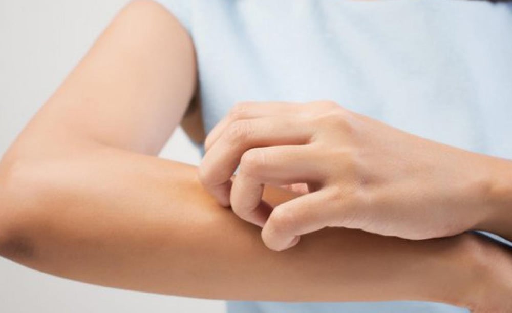 Cetirizin là thuốc chống triệu chứng dị ứng