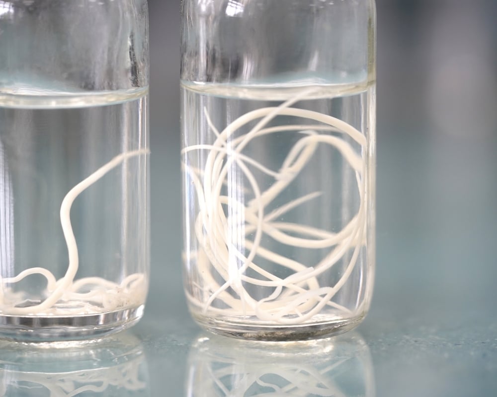 Chẩn đoán nhiễm ký sinh trùng