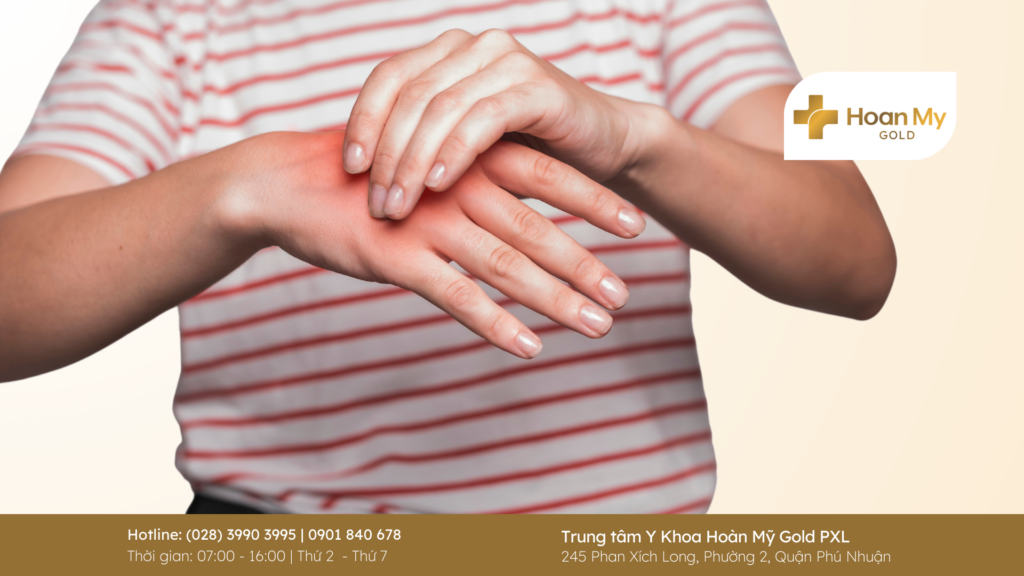 High Uric Acid Levels: Causes, Symptoms, and Effective Prevention