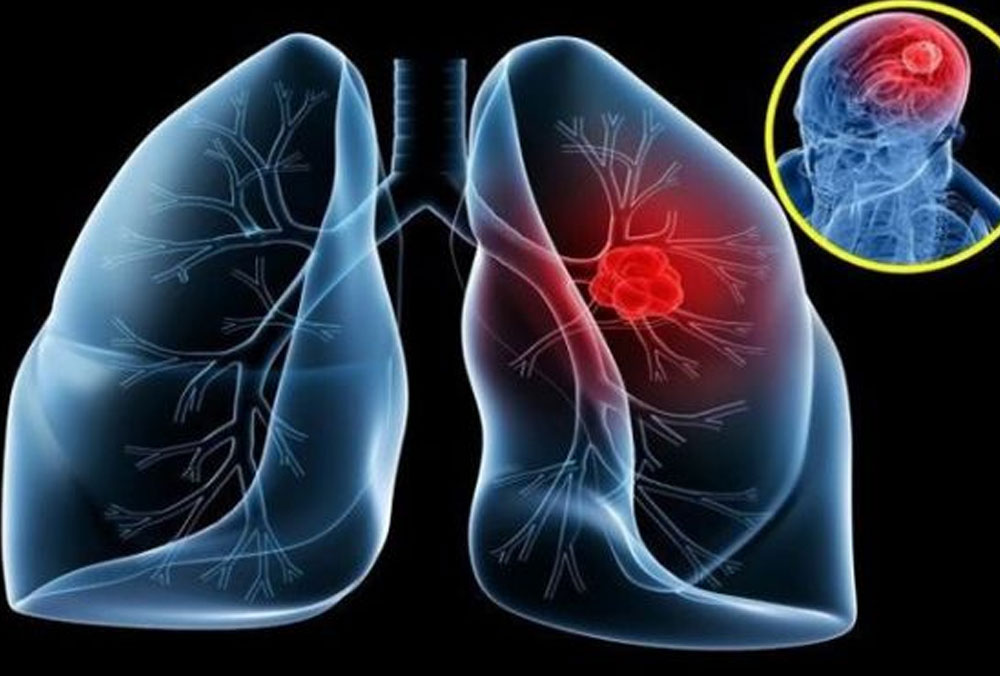 Công dụng của Fucoidan