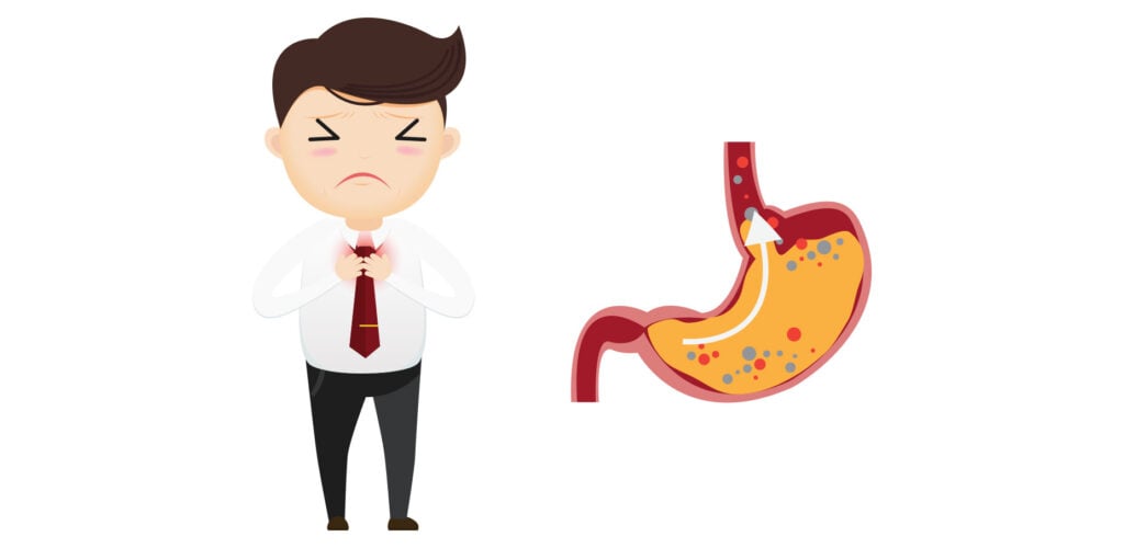 công dụng của thuốc gaviscon