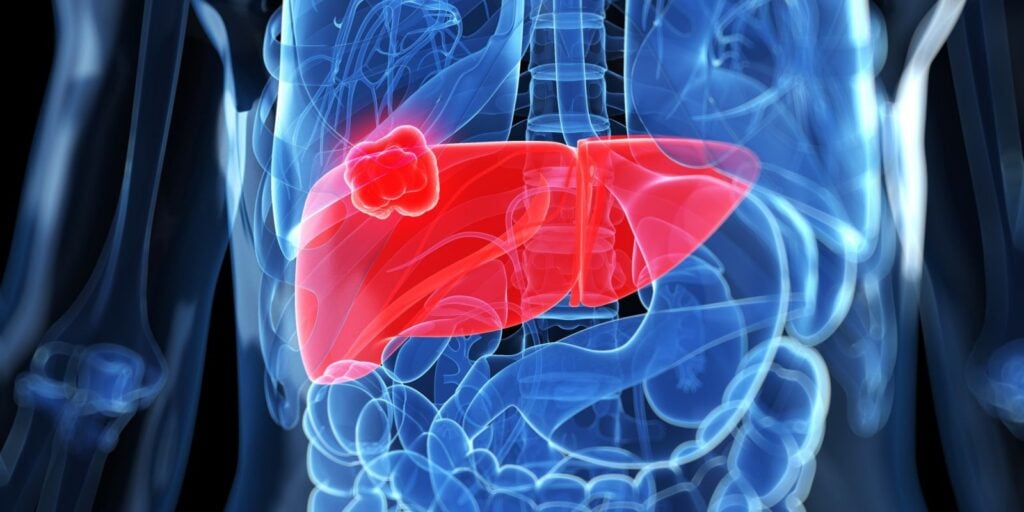 Giảm tình trạng của bệnh lý Parkinson 