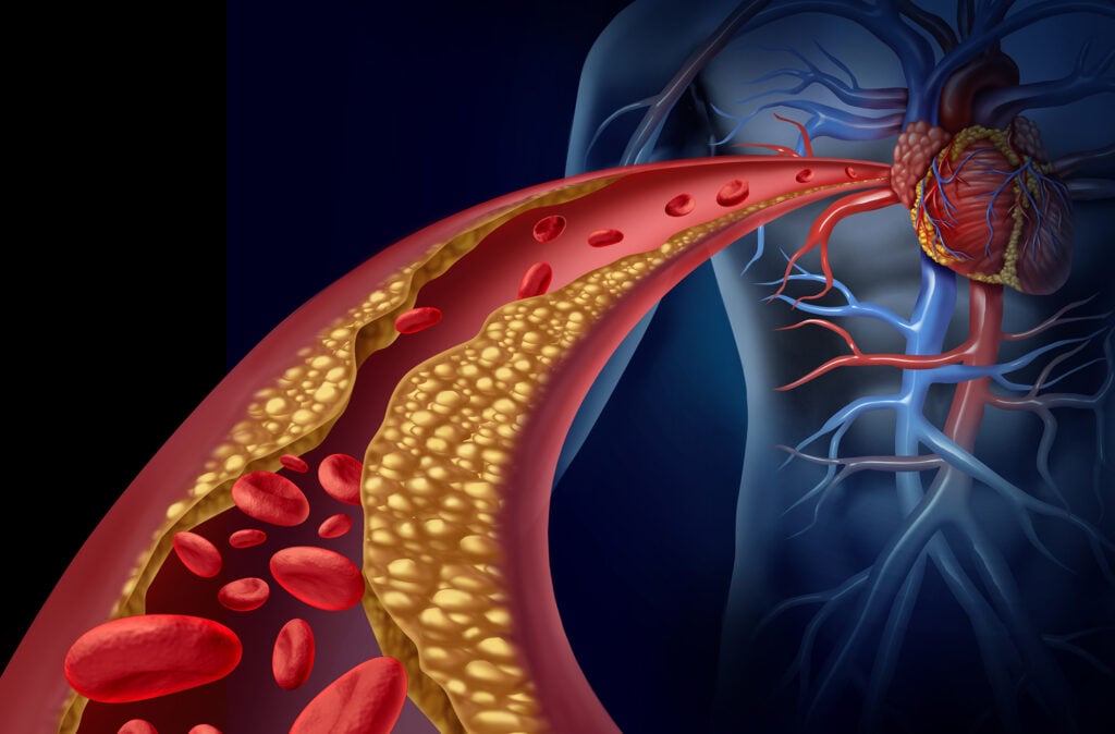 Phòng các bệnh tim mạch