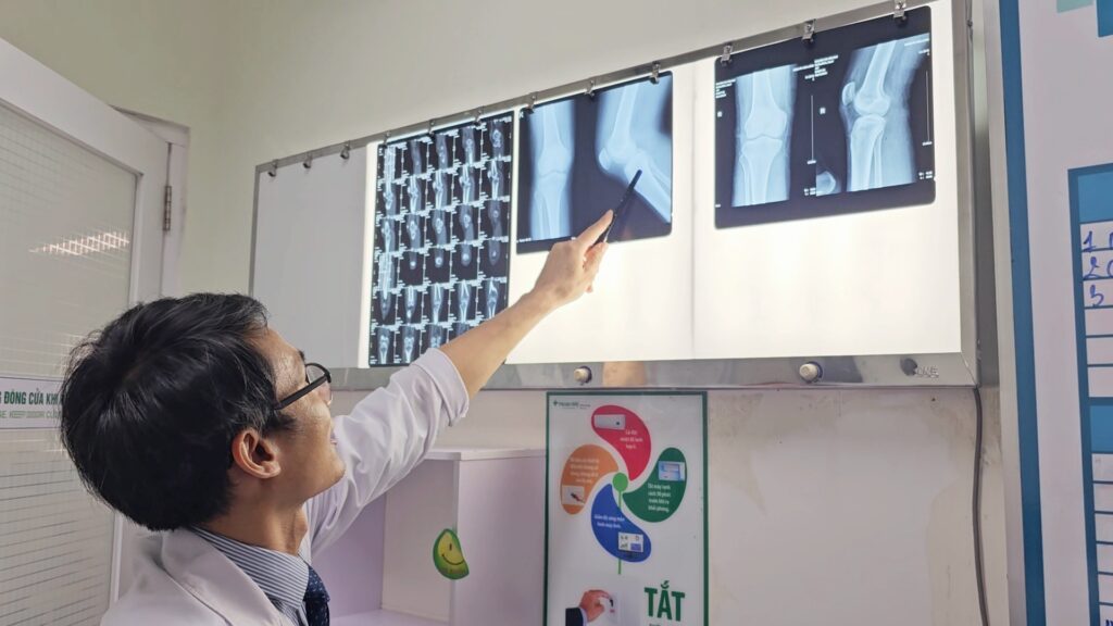 Điều trị thành công cho người bị bong điểm bám dây chằng chéo sau gối phải