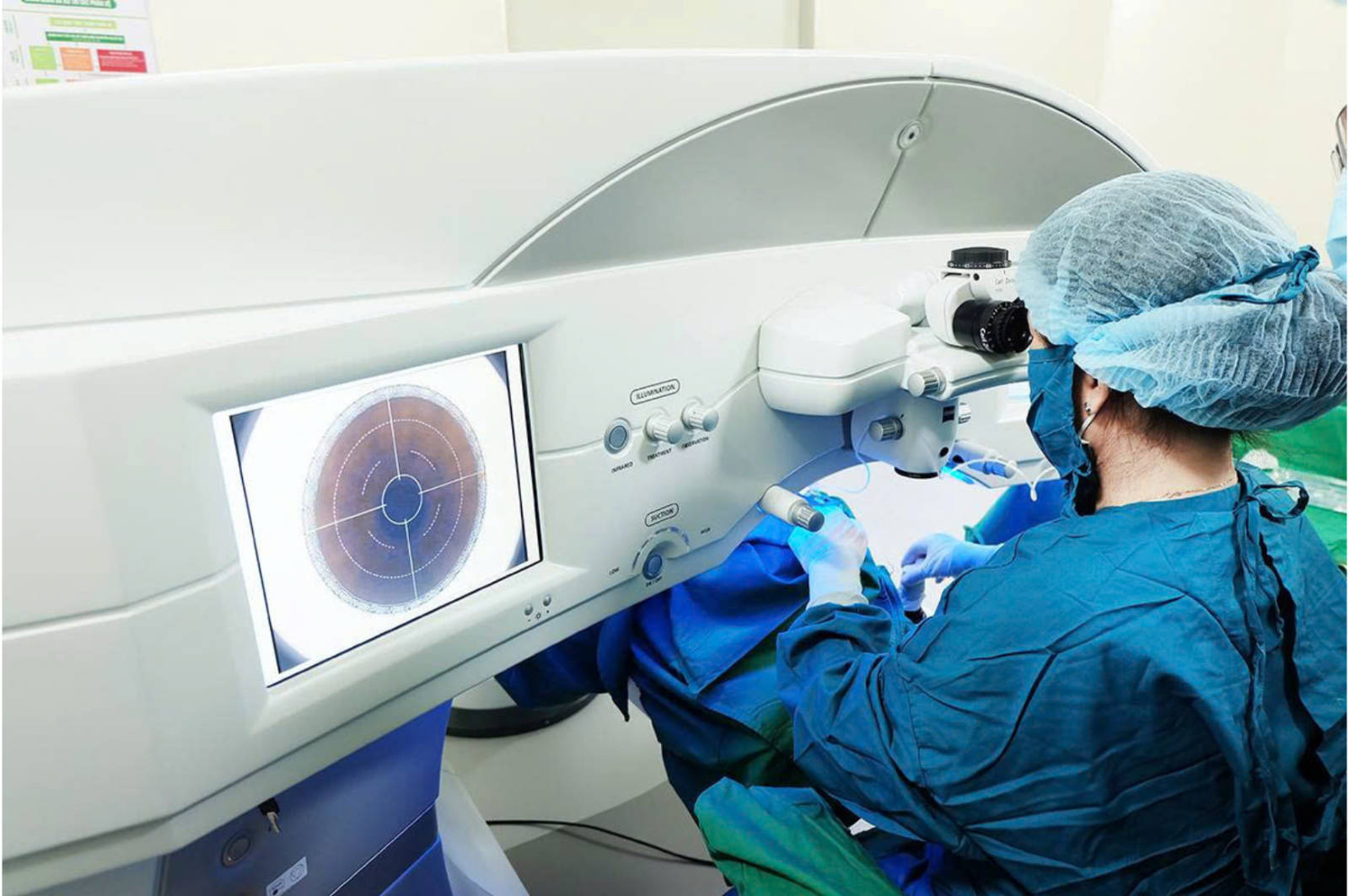 Femto Lasik Surgery Package
