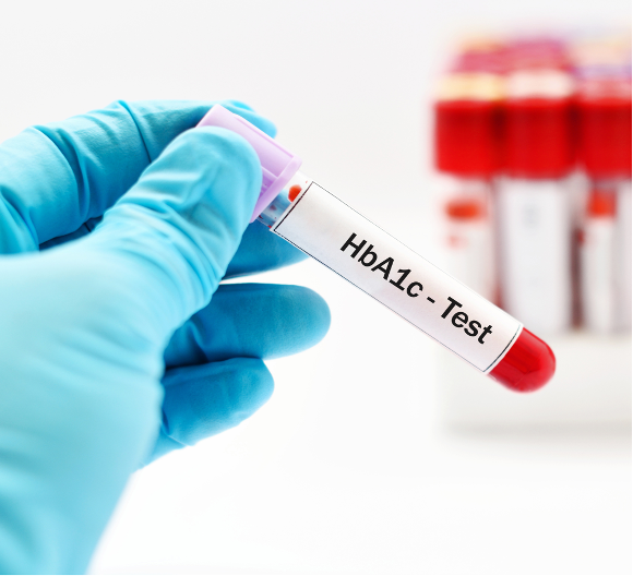 Những biến chứng nguy hiểm của đái tháo đường và cách phòng ngừa