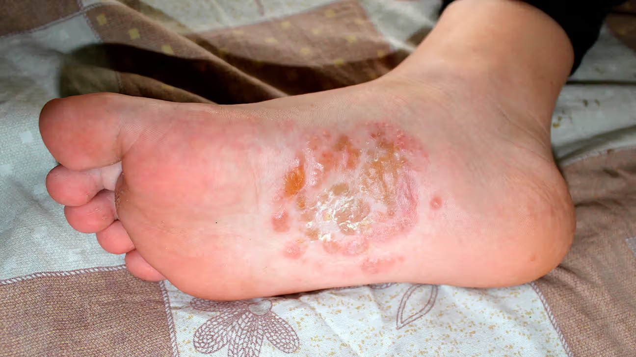 Nguyên nhân gây bệnh