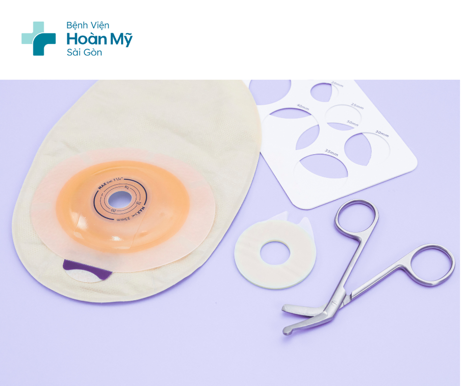 Những điều cần biết khi chăm sóc hậu môn nhân tạo tại nhà