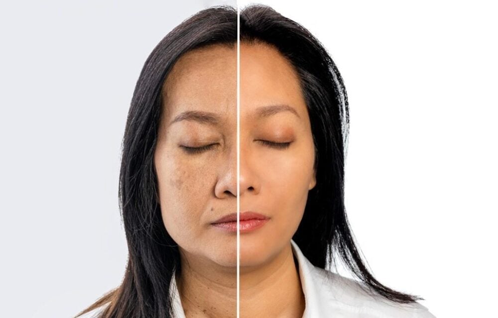 Retinol giúp làm chậm quá trình lão hoá da