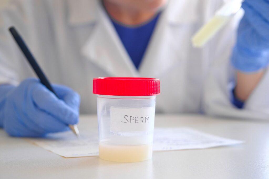 Lấy tinh trùng và lọc rửa mẫu