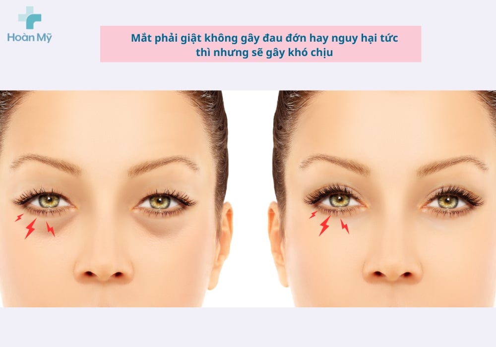 Co giật cơ mí mắt phải liên tục từ vài giây cho đến 1 hoặc 2 phút