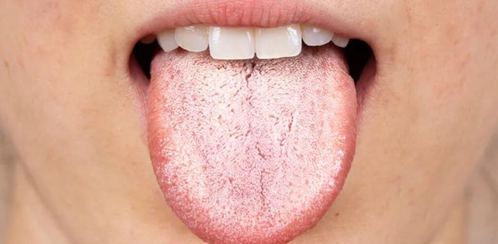 Nấm candida là gì?