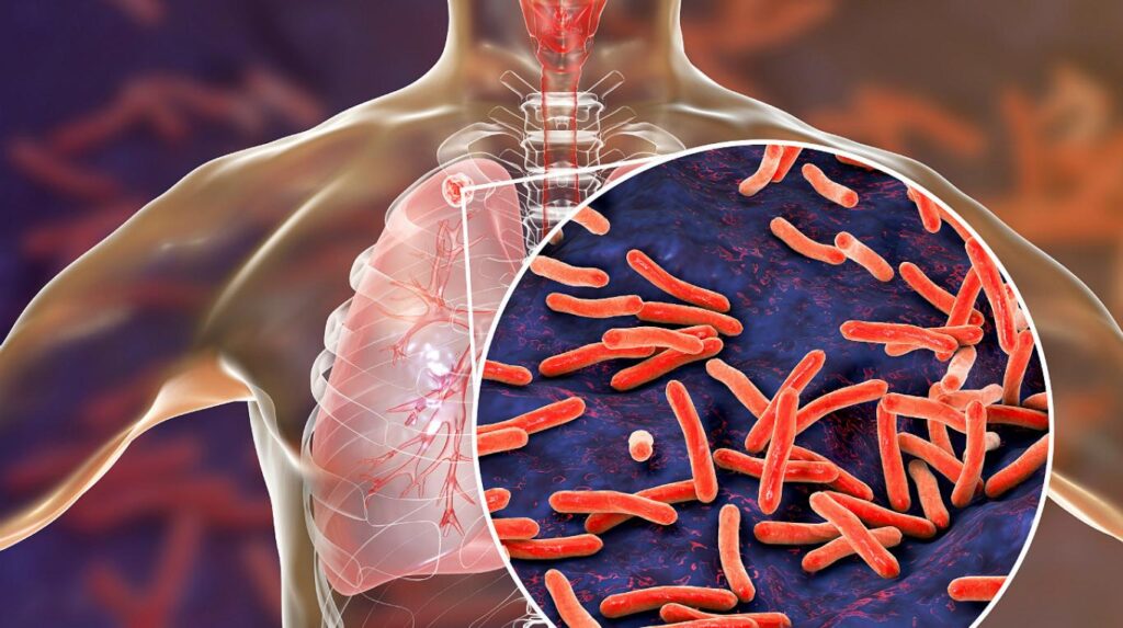 Nguyên nhân dẫn đến bệnh có thể là do nhiều yếu tố khác nhau 