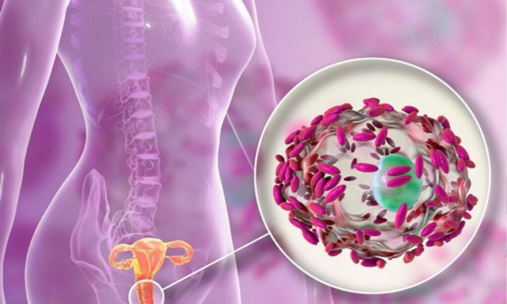 Nếu nấm Candida sẽ phát triển quá mức và làm thay đổi đặc tính, màu sắc và mùi khí hư 