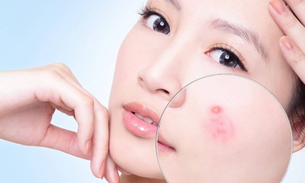 Công dụng của Niacinamide đối với làn da