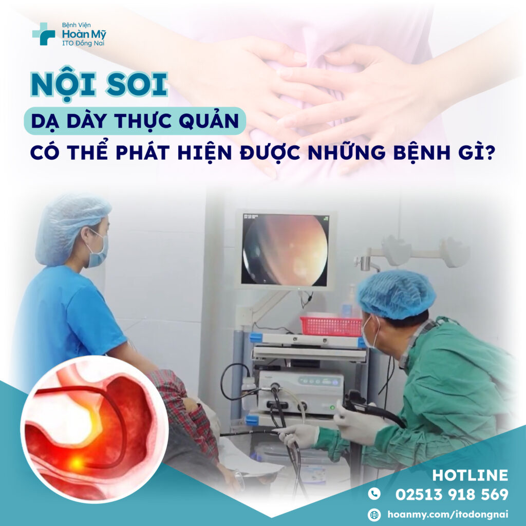 Nội soi dạ dày thực quản có thể phát hiện được những bệnh gì?