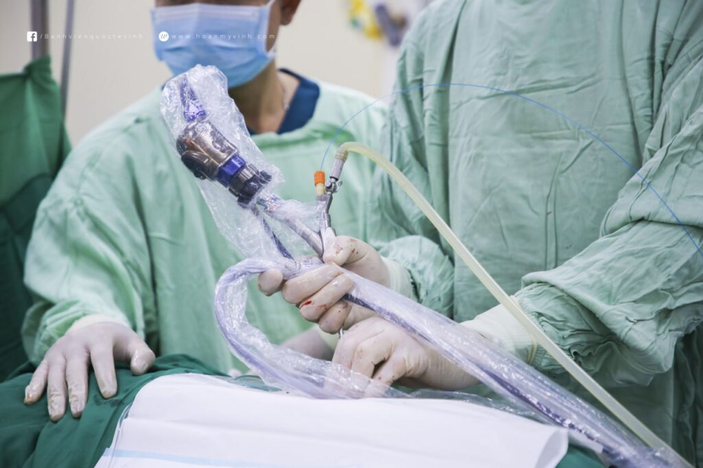 Bác sĩ đang soi sỏi thận