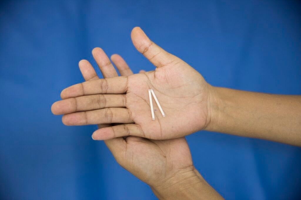 Que cấy Jadelle gồm có 2 que hình chữ V