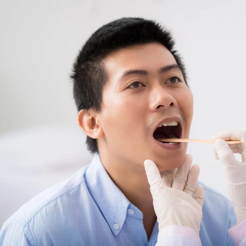 Nguyên nhân hình thành sỏi amidan