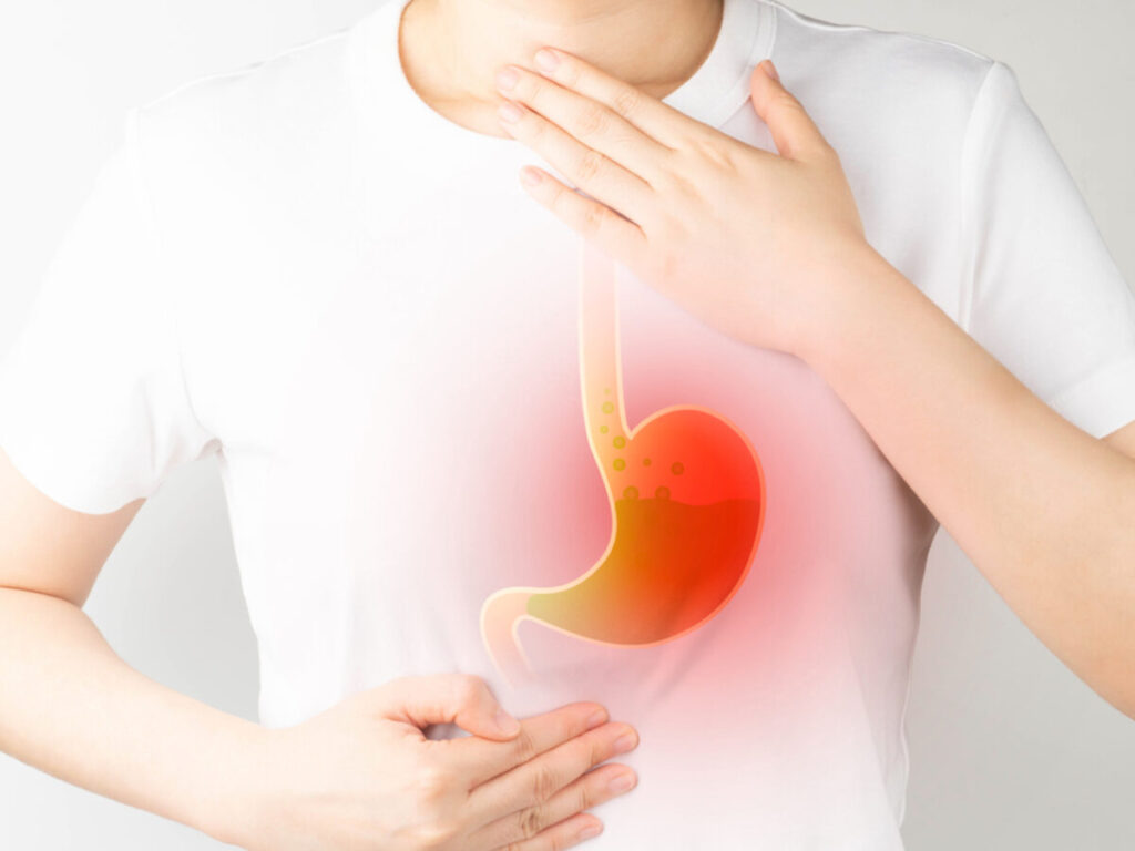 Những tác dụng phụ của thuốc Gaviscon mà bạn nên biết để cứu chữa kịp thời