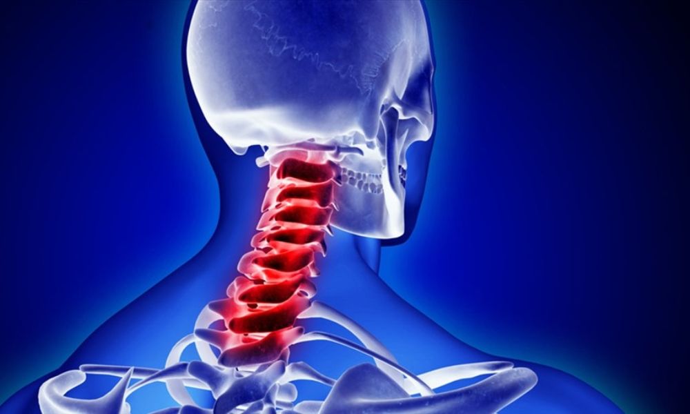 Thoái hóa đốt sống cổ là căn bệnh thường gặp