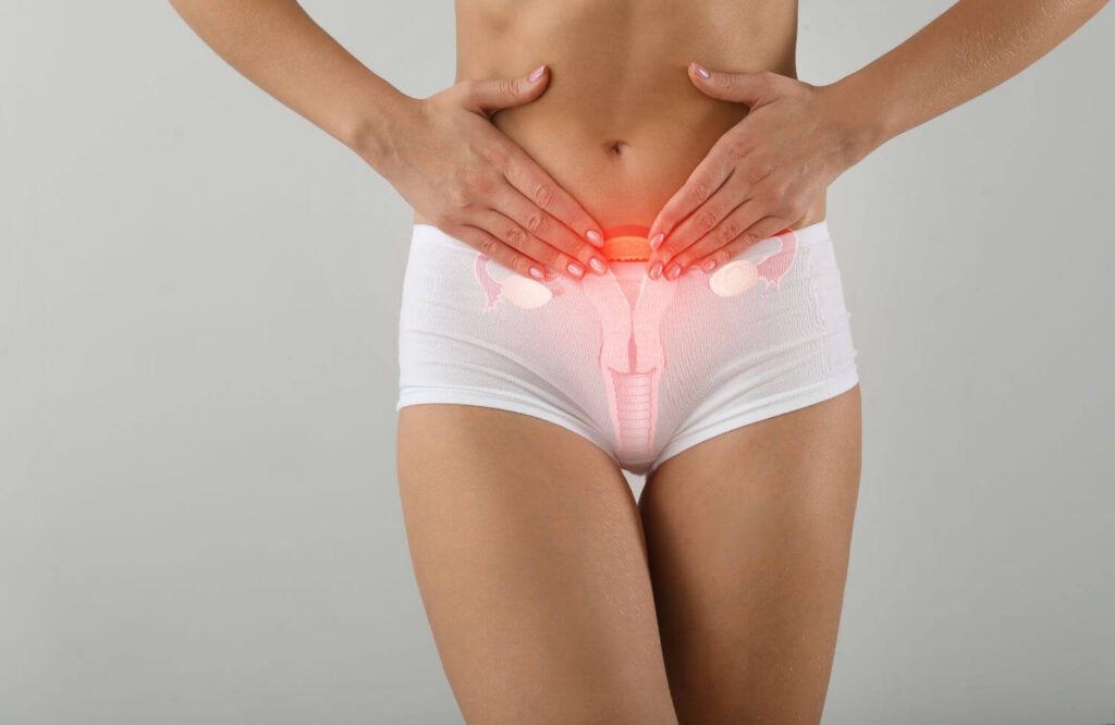 Đau bụng kinh thứ phát 