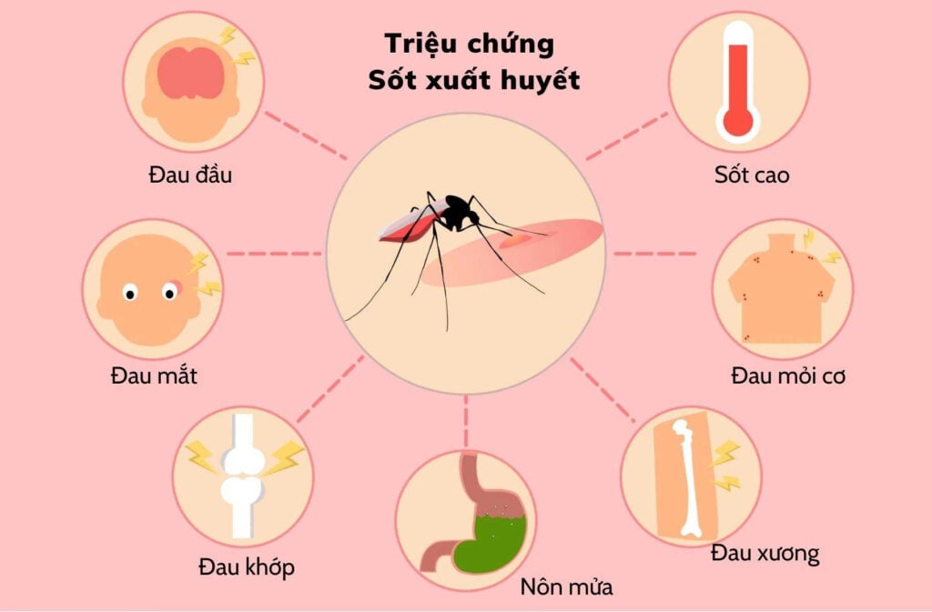 Triệu chứng sốt xuất huyết 