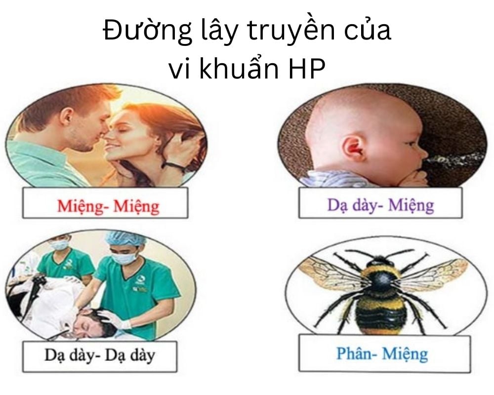 Các con đường lây nhiễm của vi khuẩn HP