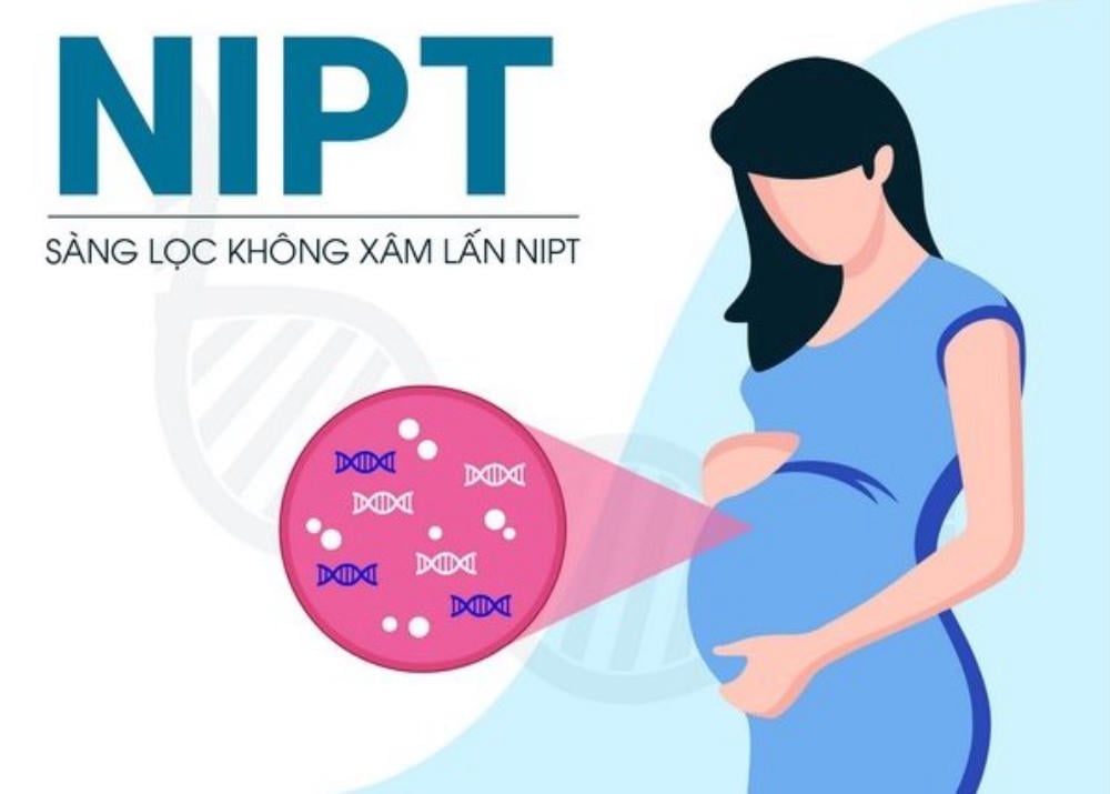 NIPT là xét nghiệm sàng lọc không xâm lấn