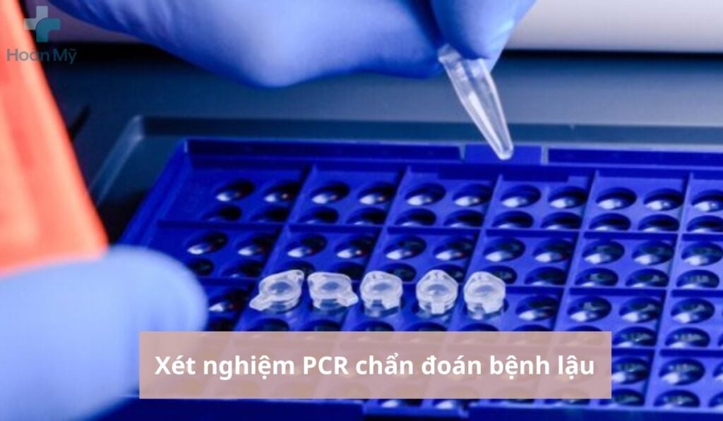 Xét nghiệm chẩn đoán bệnh