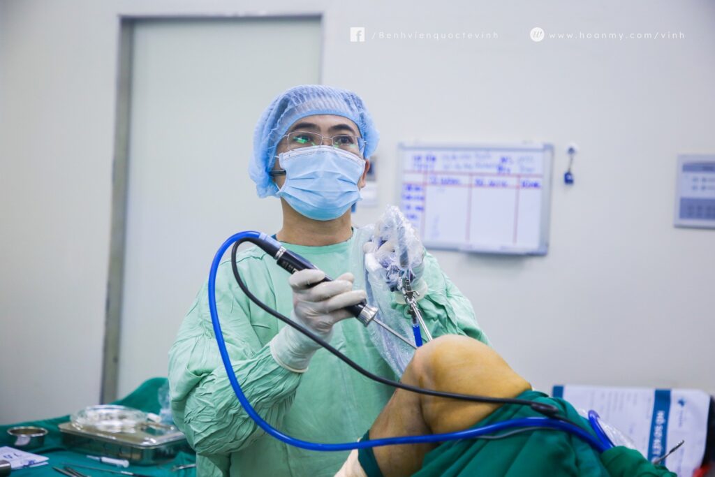 Nội soi tái tạo dây chằng chèo trước cho người bệnh bị chấn thương lâu năm