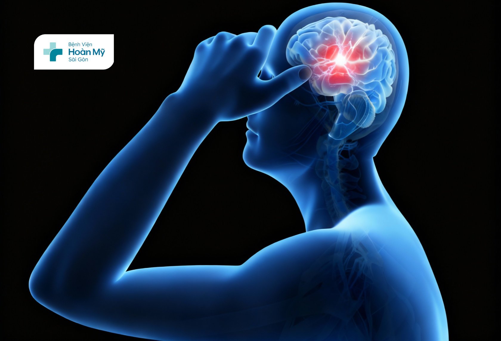 Nhận biết sớm, can thiệp kịp thời – Yếu tố quyết định trong điều trị nhồi máu não 