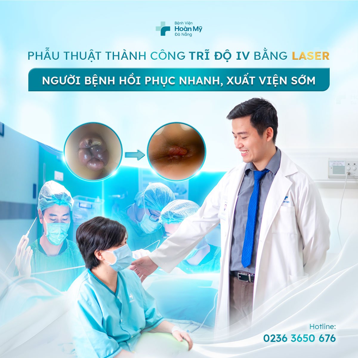 Phẫu thuật thành công ca trĩ độ IV bằng công nghệ Laser – Bước tiến trong điều trị ít xâm lấn