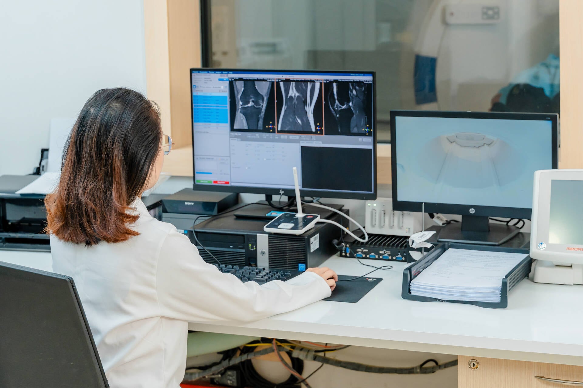 Gói tầm soát toàn diện – thoái hóa & loãng xương